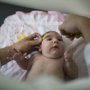 brazil-zika-birth-defects-b887-7602-6192-1454036396