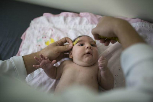 brazil-zika-birth-defects-b887-7602-6192-1454036396
